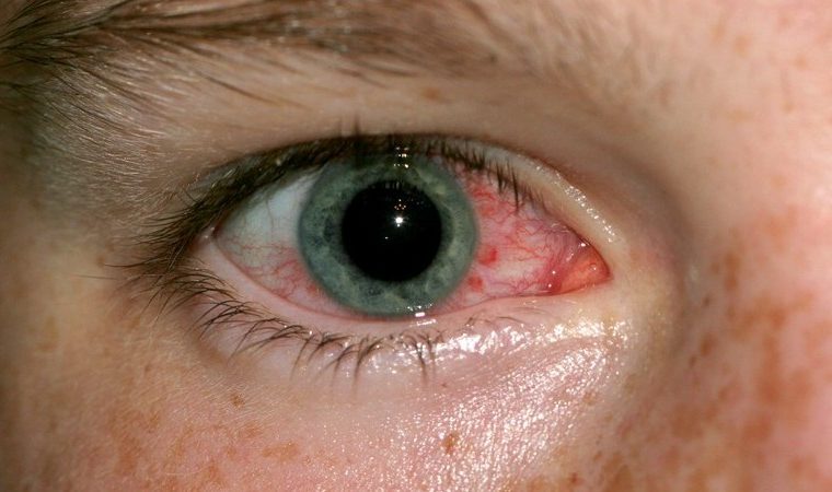 auge-760x450.jpg