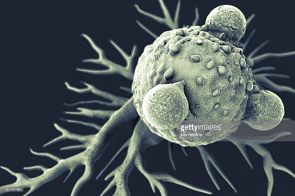 lymphocytes-and-cancer-cell-picture-id167157660.jpeg