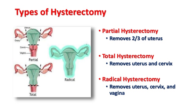 hysterectomy-7-638.jpg