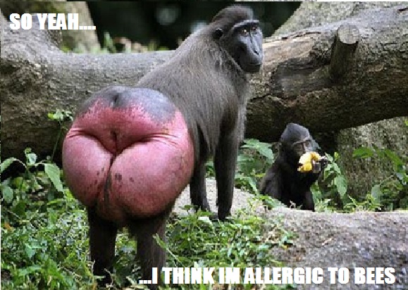 bee alergies1.jpg