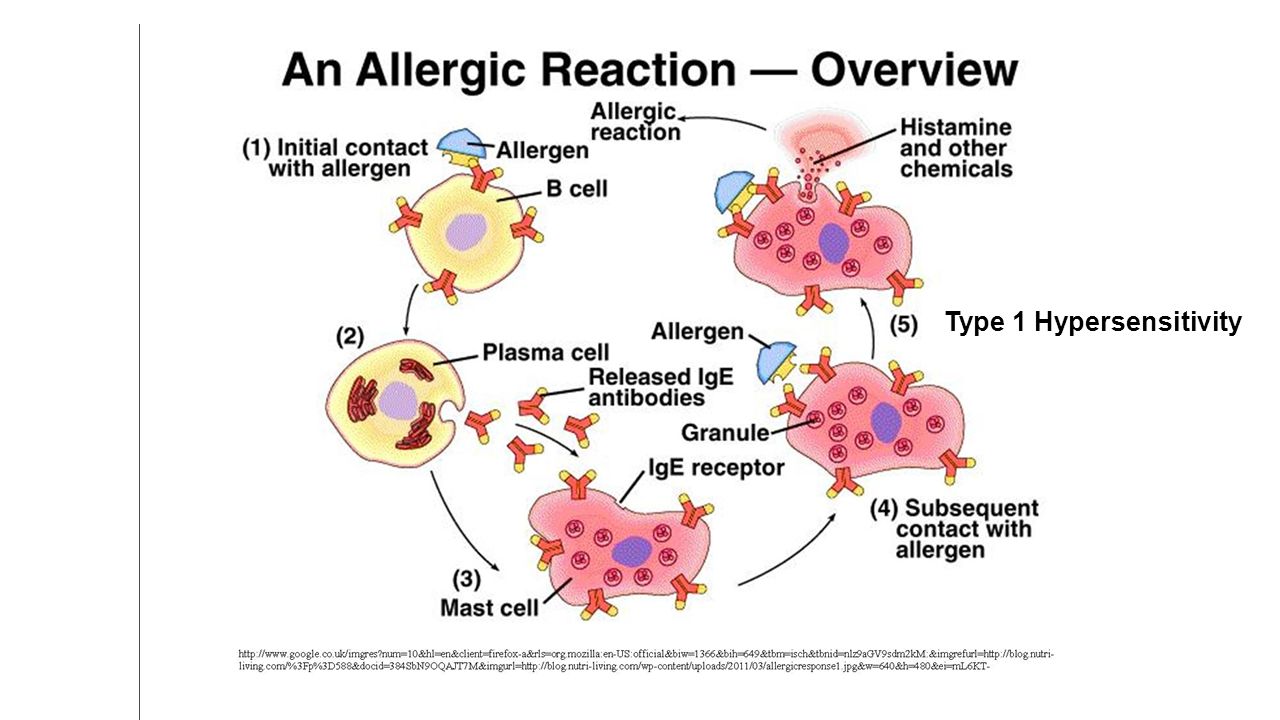 type I hypersensitivity.jpg