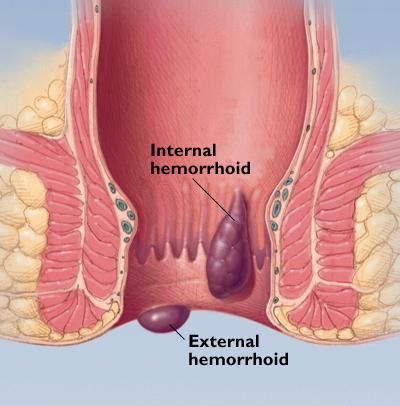 internal ksternal.jpg