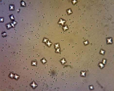 causas de cristales de oxalato cálcico en orina causas de cristales de oxalato cálcico en orina