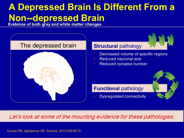 hanipsych-updates-on-neurobiology-and-neurotoxicity-of-depression-13-638.jpg