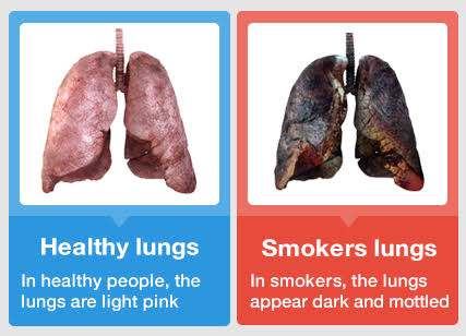 effects of smoking on the lungs