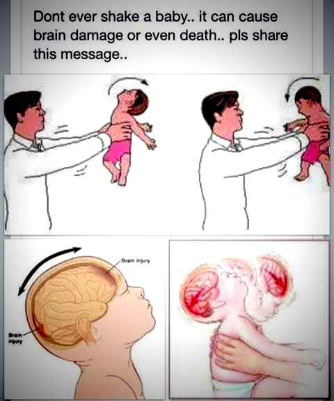 Shaking-kids-causes-brain-hemorrhage.jpg