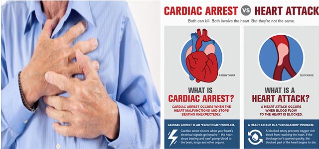 Cardiac Arrest Vs Heart Attack Steemit