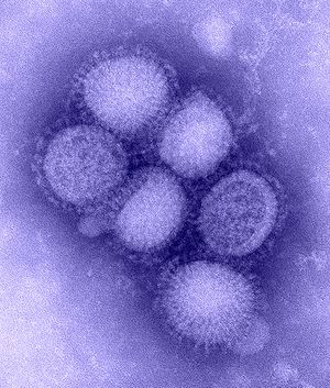 300px-H1N1_influenza_virus.jpg