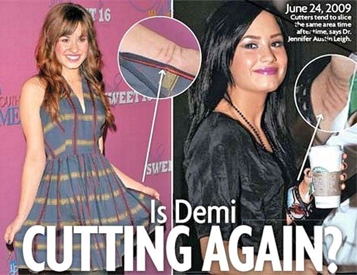 demi-lovato-cutting-scars.jpg