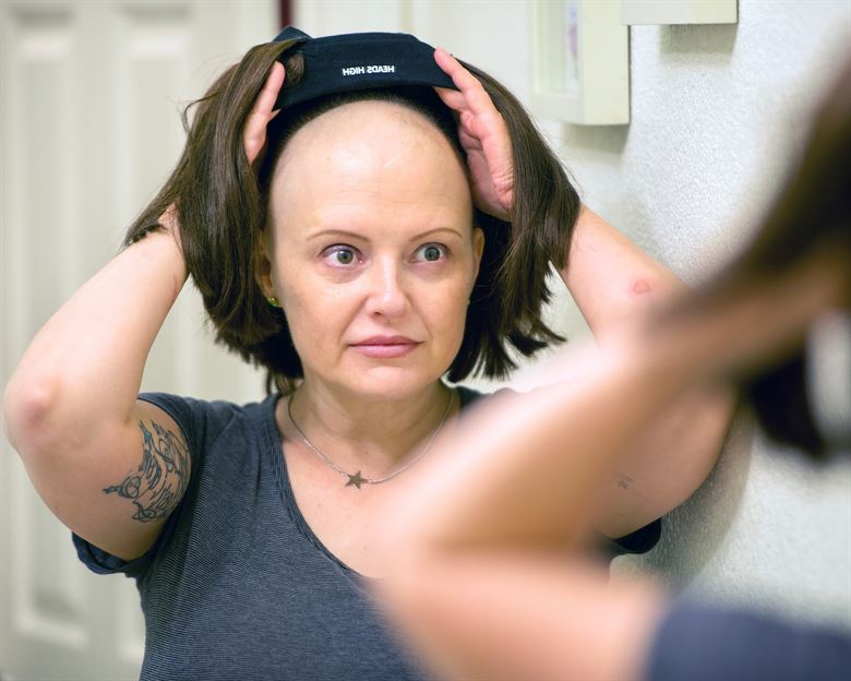 Химиотерапия при раке молочной железы всегда ли выпадают волосы