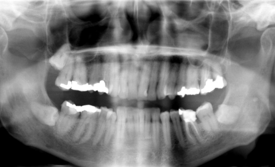 stem-cell-teeth-cavity-root-canal.jpg