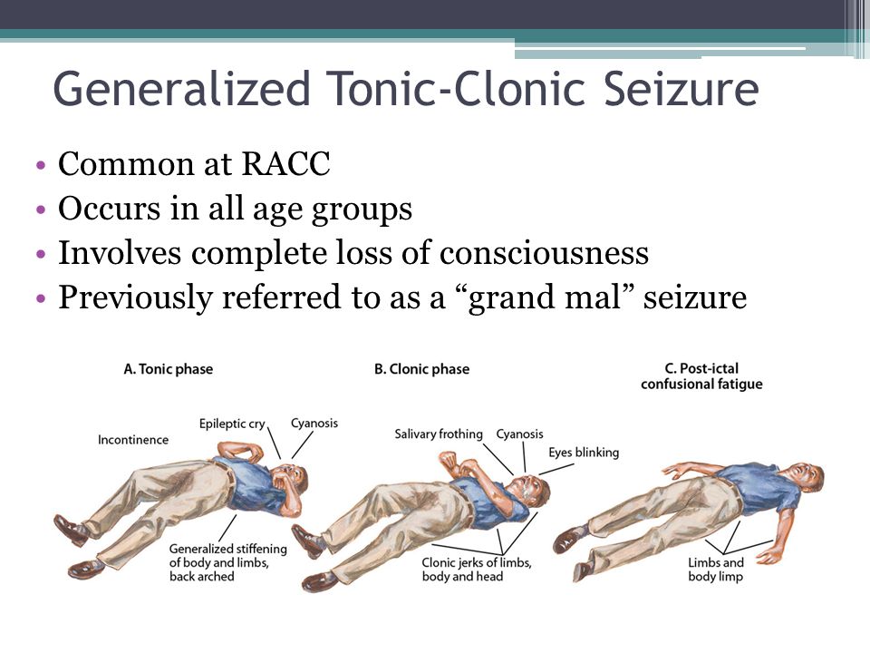 Generalized+Tonic-Clonic+Seizure.jpg