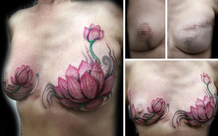 mastectomy-abuse-scar-women-free-tattoo-flavia-carvalho-daedra-art-brasil-2.jpg