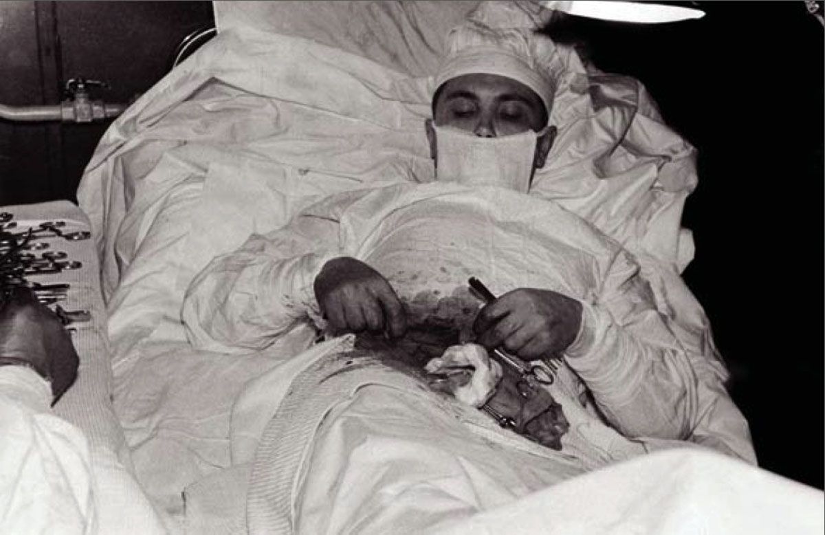 Dr. Leonid Rogozov operating himself to remove his appendix in Antarctica, 1961 (2).jpg