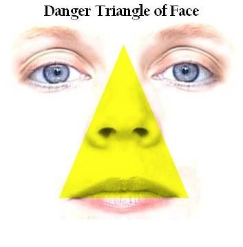 danger-triangle-of-face.jpg