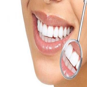 Dental Veneers.jpg