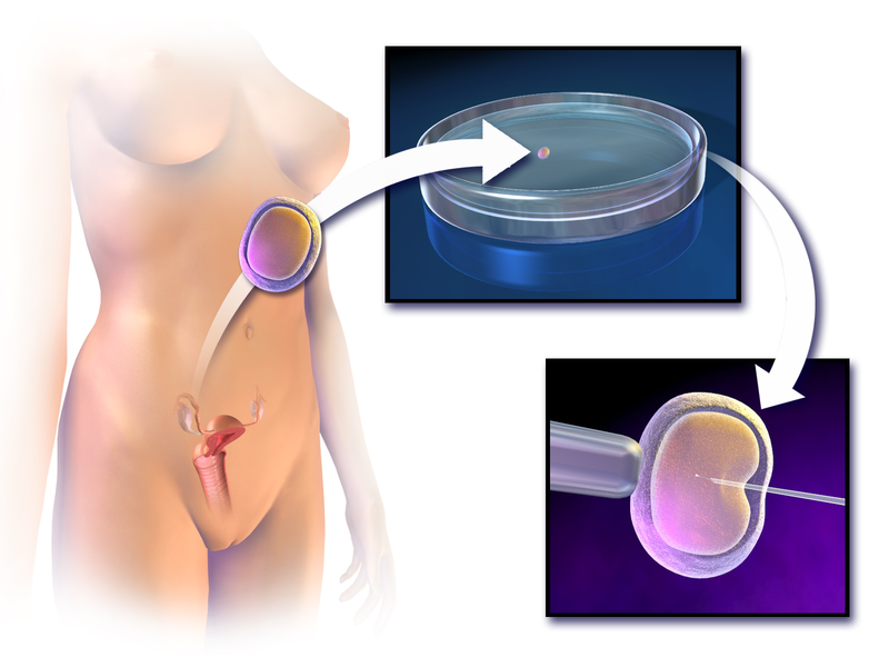 Blausen_0583_InVitroFertilization.png