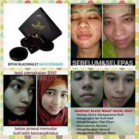 testimoni-sabun-black-walet.jpg