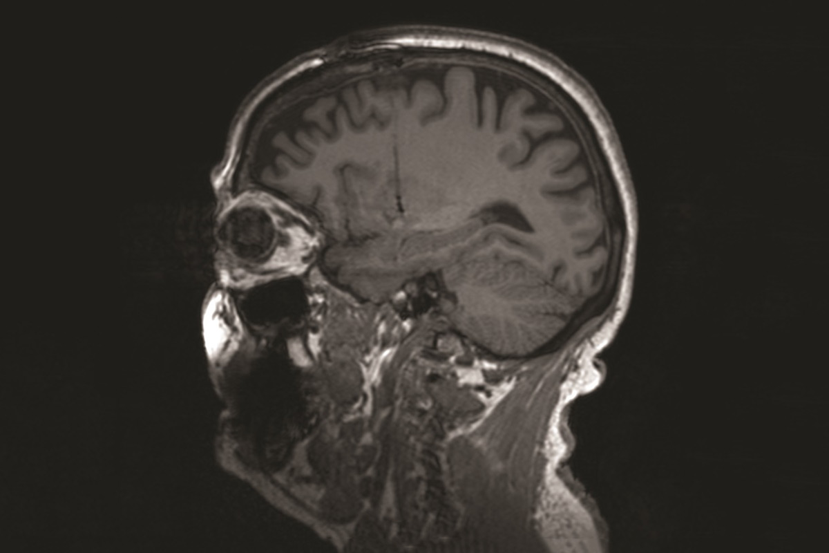 mri-b-002.jpg