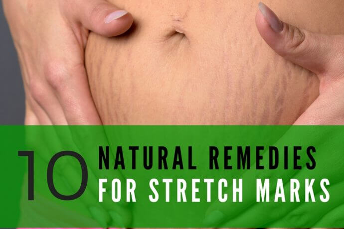 natural-remedies-for-stretch-marks-690x460.jpg