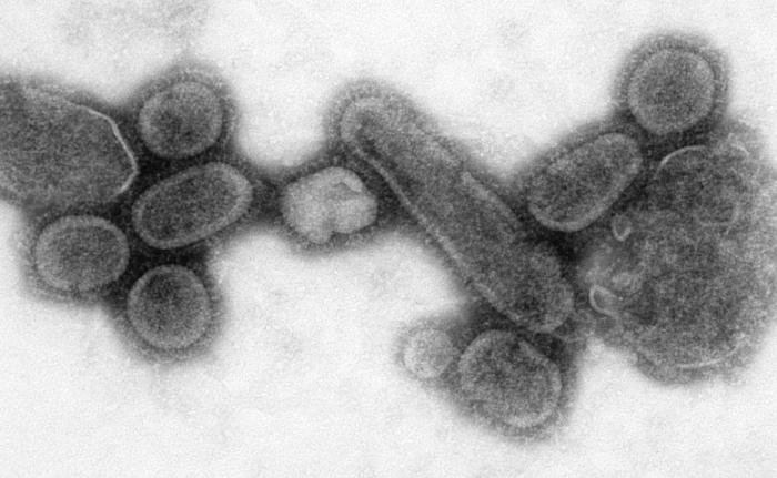 Spanish Flu Virus