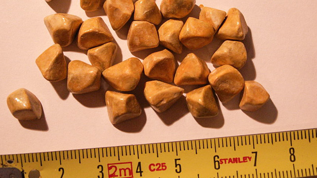 642x361_Gallstones_SLIDE_1.jpg