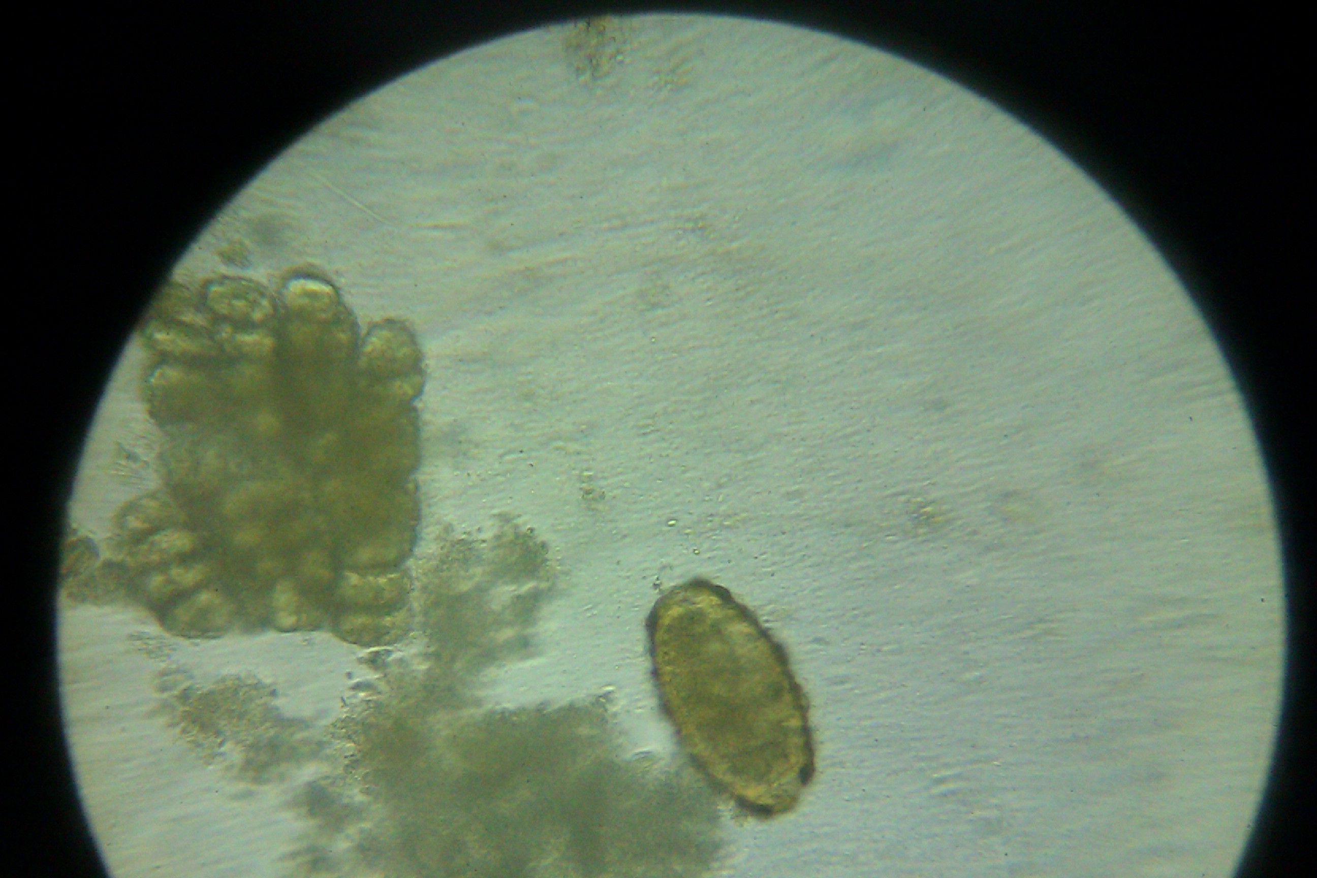 unefertilized ascaris egg.jpg