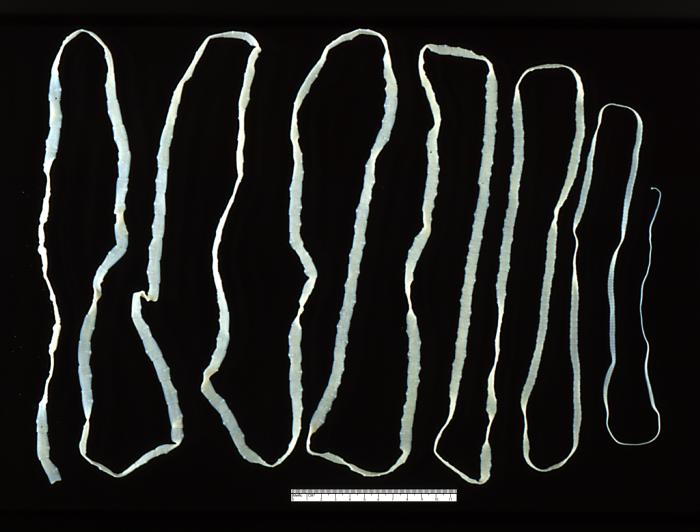 The Strangest Medical Cases Ever Documented