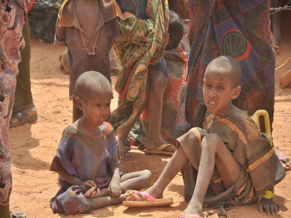 Malnourished_children,_weakened_by_hunger.jpg