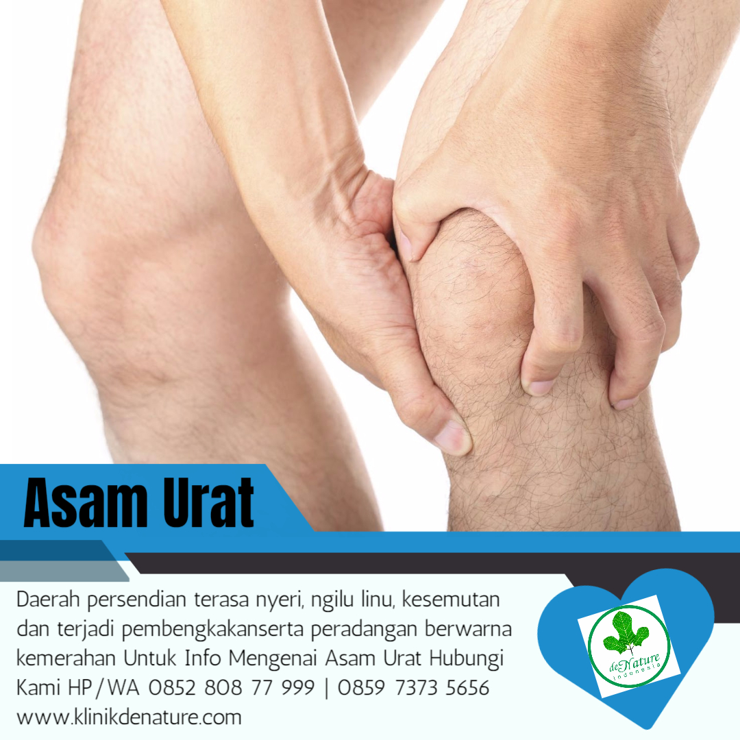 obat asam urat murah.jpeg