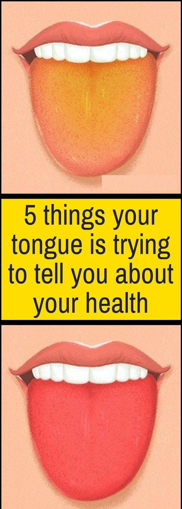 5-Things-Your-Tongue-Is-Trying-To-Tell-You-About-Your-Health-1.jpg