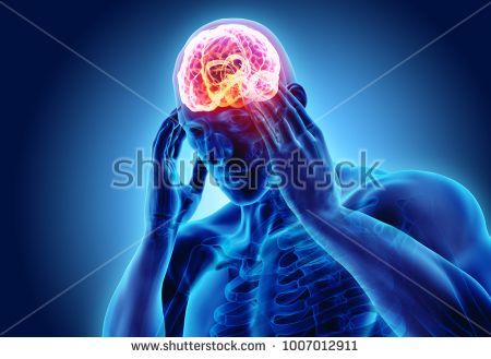 stock-photo--d-illustration-of-headache-human-x-ray-medical-concept-1007012911.jpg