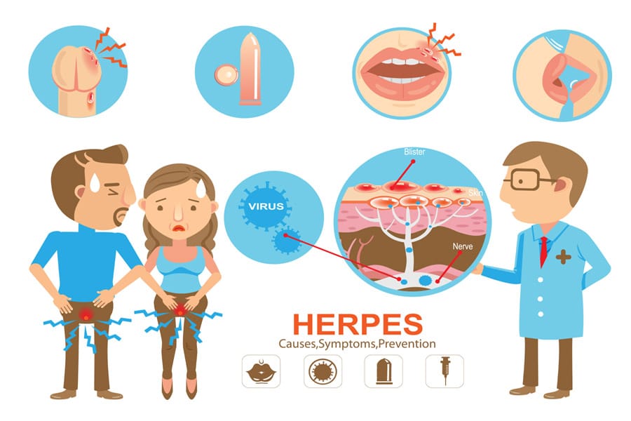 Herpes.jpg
