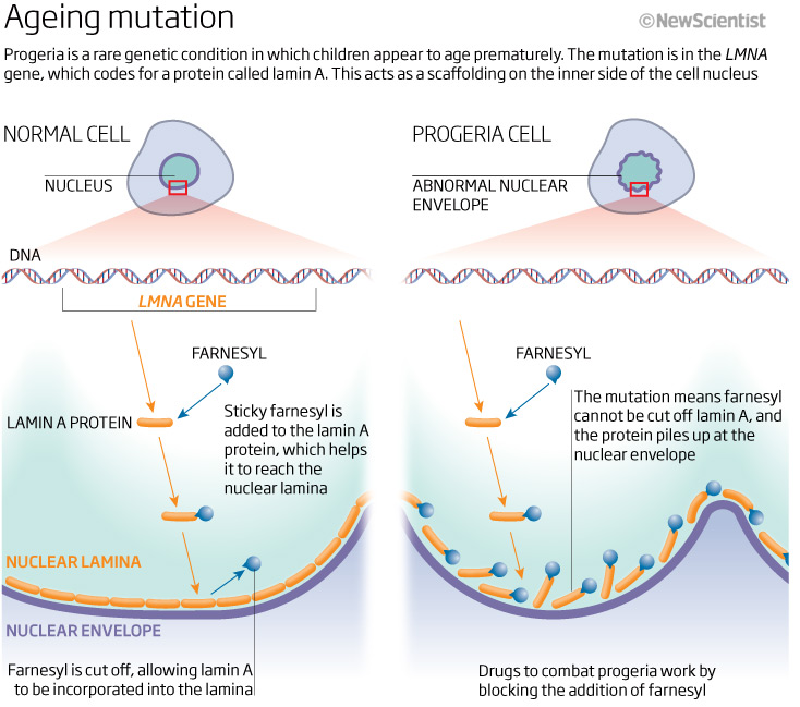 Progeria mutation.jpg