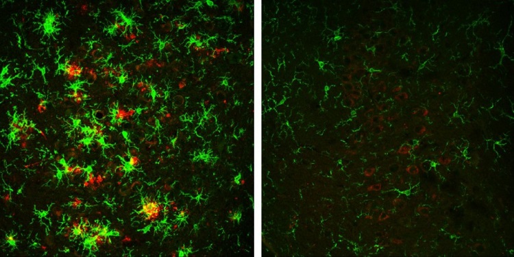 Alzheimer-fare-modellerinde-geri-cevrildi-bilimfilicom.jpg