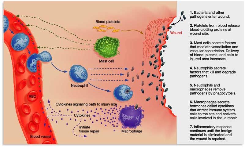 image_Inflammatory-Response2.jpg