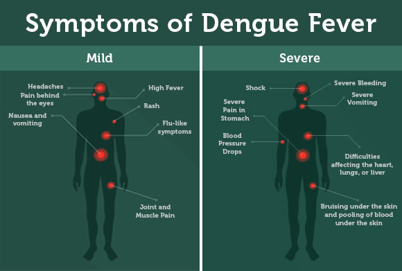 dengue-symptoms-article-2.jpg