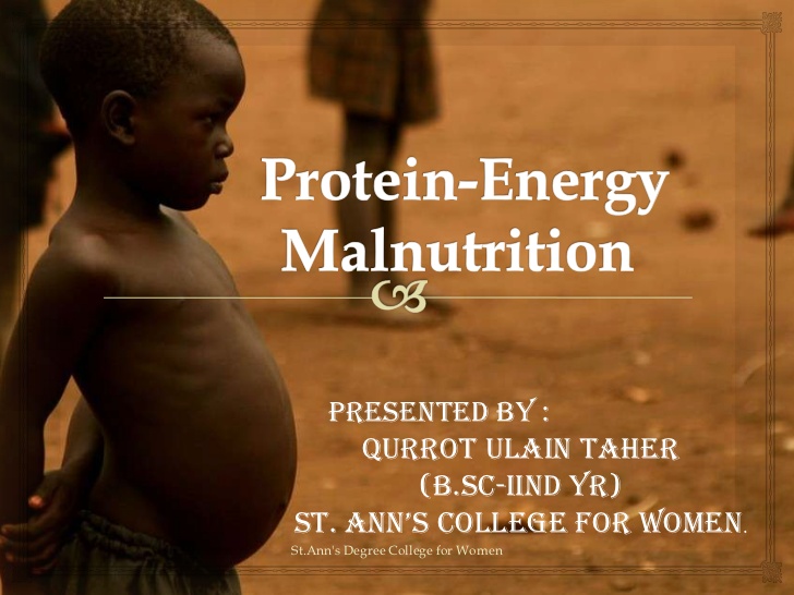 protein-energy-malnutrition-1-728.jpg