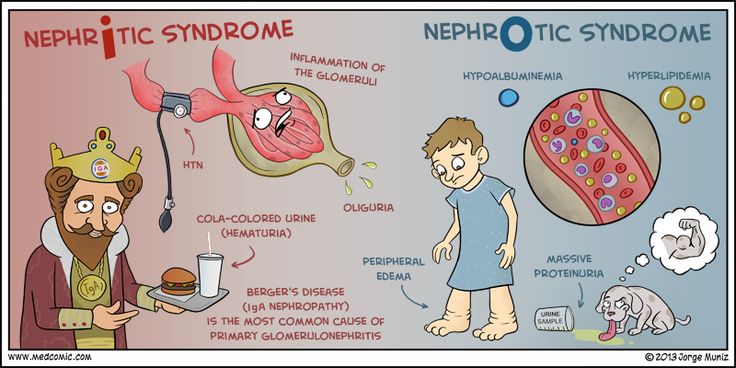nephrotic-vs-nephritic.jpg