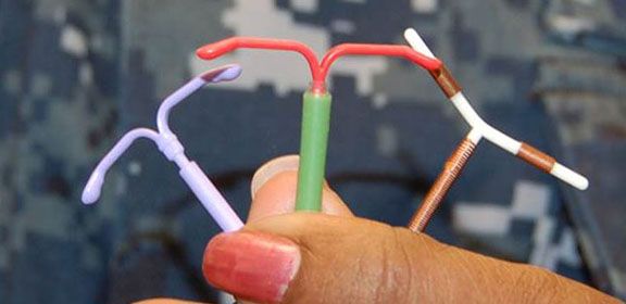 Intrauterine Contraceptive Devices.png