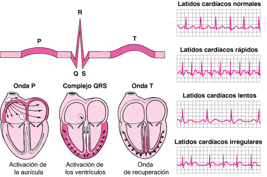 CVS_ecg_reading_es.gif