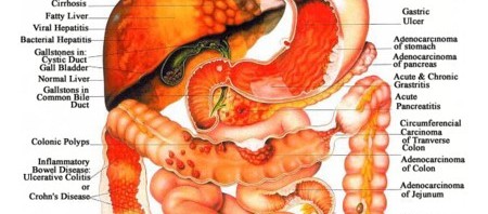 Digestive-diseases-450x198.jpg