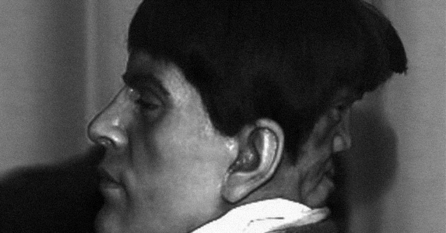 Edward-Mordake.jpg