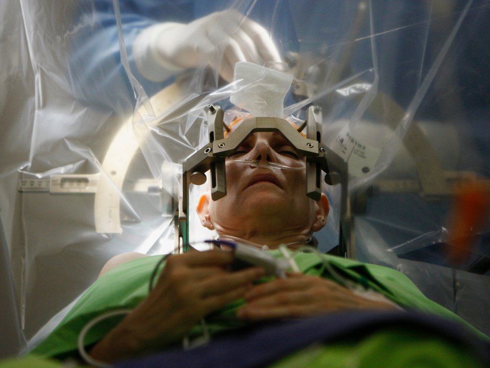deep-brain-stimulation-brain-surgery.jpg