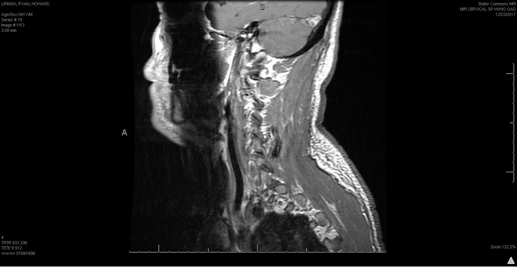 cervical 7.jpg