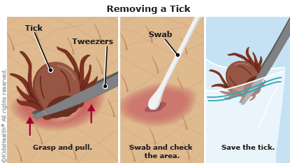 Remove a tick.png