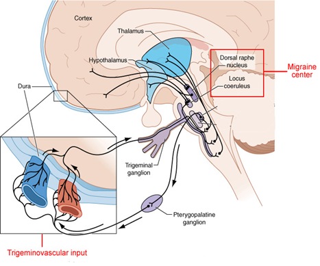 migraine_pathogenesis_thumb1.jpg