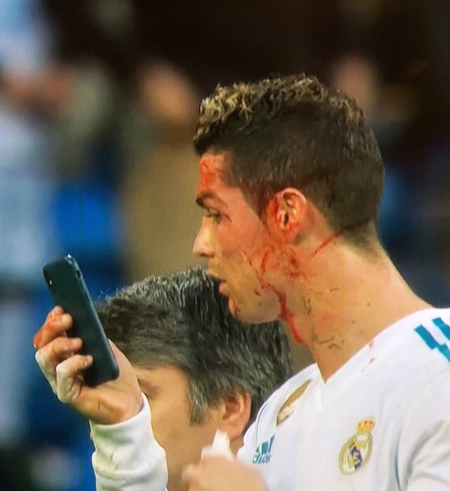 Strong Injury Sinking Ronaldo S Face With Blood Steemit