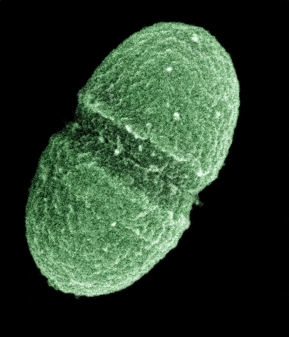 Enterococcus_faecalis20023-300.jpg