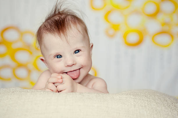 cheerful-little-baby-girl-with-downs-syndrome-picture-id178792909.jpg